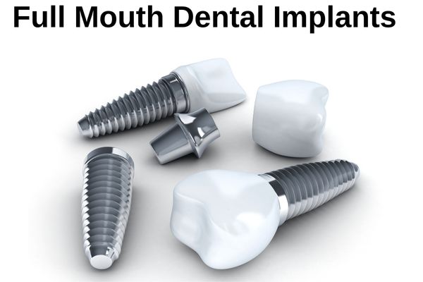 full mouth dental implant in turkey