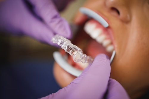 invisalign Turuncu Dental Clinic Antalya, Turkey