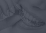 Invisalign - Şeffaf Plak antalya