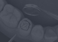 Diş Eti İltihabı-Periodontoloji -Nedir